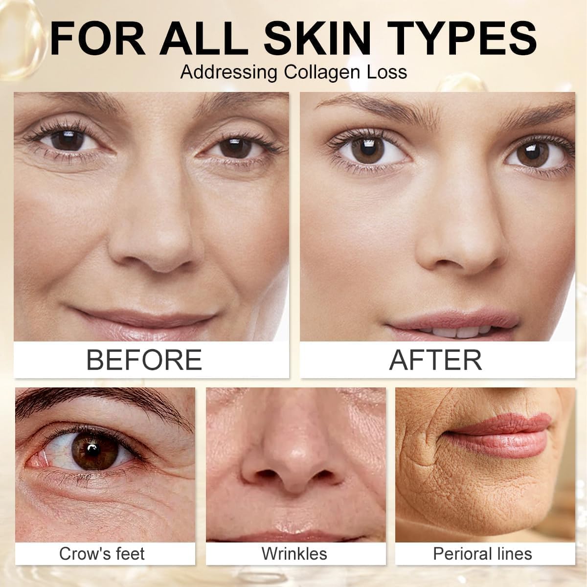 Bee Venom Wrinkle Removal Cream